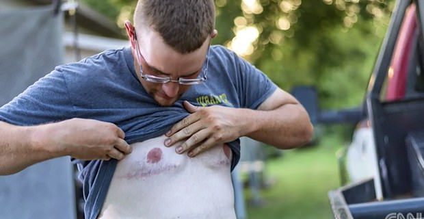 Johnson & Johnson to pay $US8bn to man who grew breasts after taking anti-psychotic drug