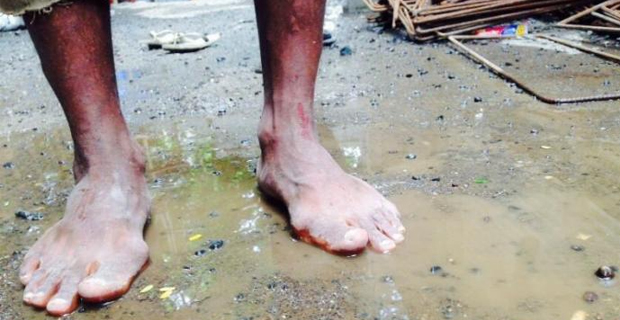 Northern Division recorded 116 Typhoid cases and 387 Leptospirosis cases in 2017