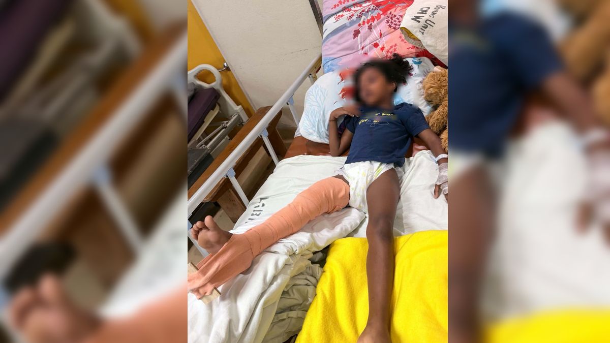 Mother wants accountability and action after daughter suffers fractured leg at school
