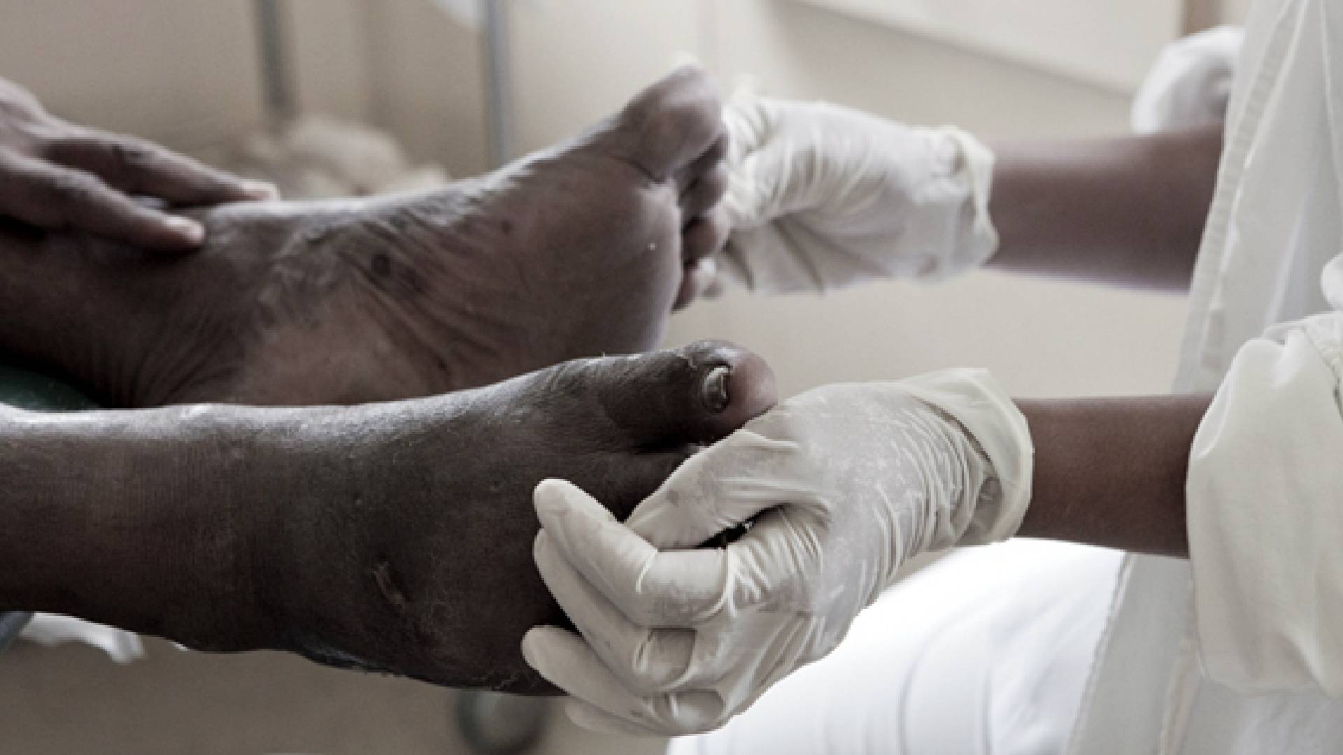 Cultural stigma, fear, transport costs, and lack of early symptoms prevent early medical care - Diabetes Fiji