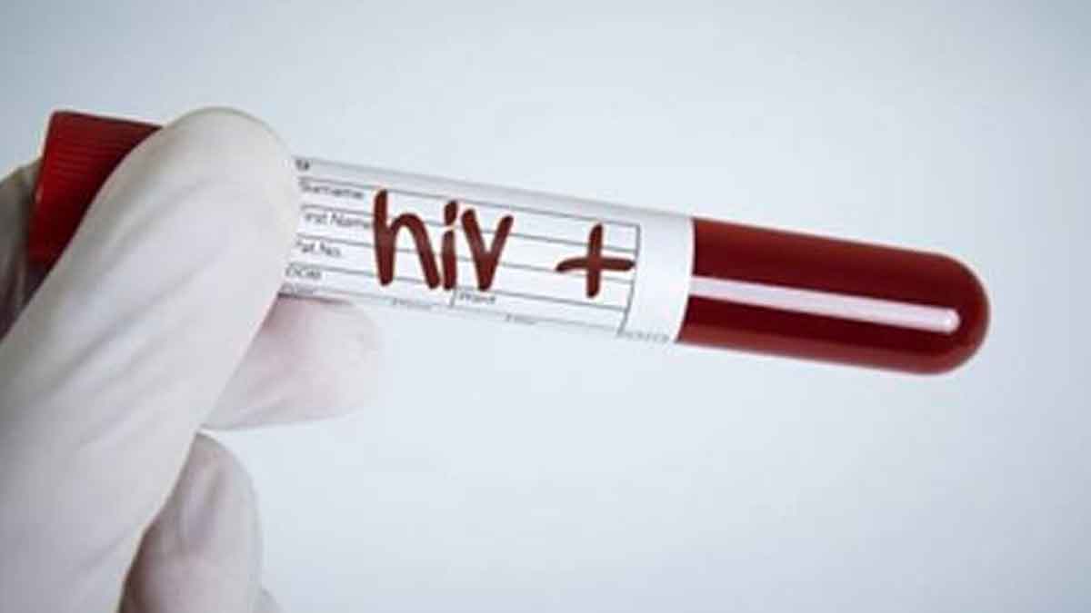 Parliament passes HIV Bill allowing needles and syringes program