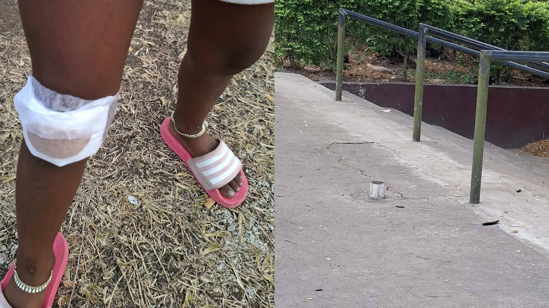 Lautoka father raises safety concerns after daughter injured near children's park