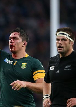Hansen dismisses McCaw elbow claims