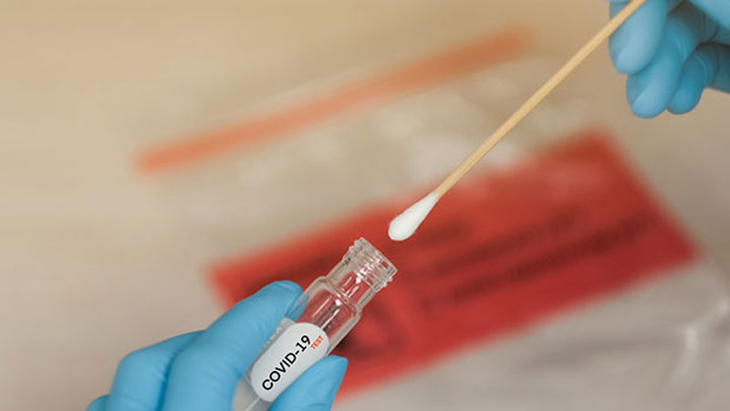 We will find new cases of COVID-19 along the way that we would not expect – Dr. Fong