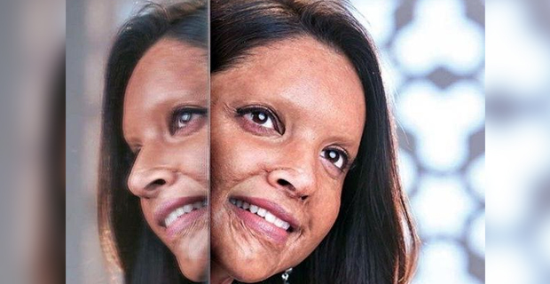 Deepika reveals look for film on acid attack survivor 