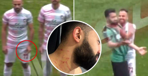 Turkish league gets crazy as player attacks another with razor blade