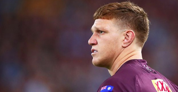 Napa will still play Game II despite broken wrist