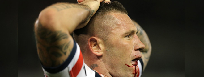 Can the Roosters survive a Cronulla Shark bite?
