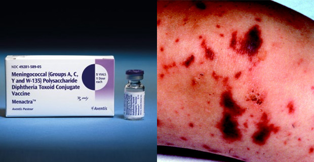 Authorities working together to prevent price gouging of Meningococcal vaccines