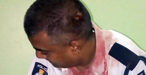 Man who allegedly injured Police Officer while throwing stones at him charged and to be produced today