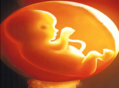 Stringent laws to fight abortion