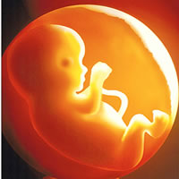 Stringent laws to fight abortion