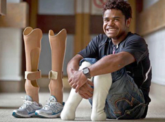 18yr old walks for the first time